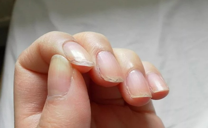 Ломкие и слоящиеся ногти – нередкое явление. Как сделать красивый и носибельный маникюр читайте в статье
