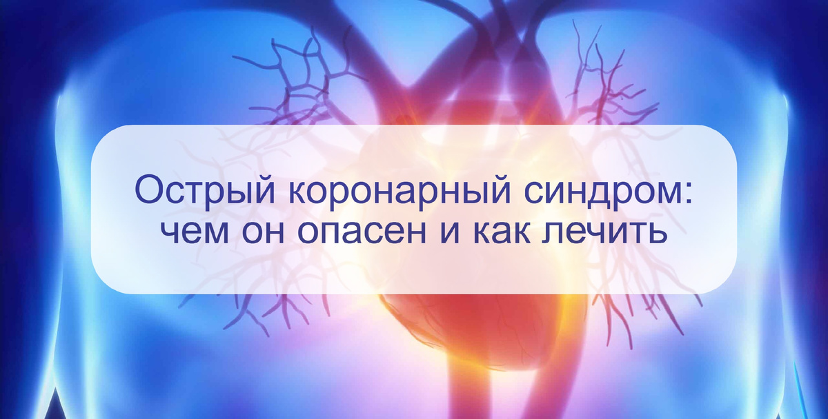 Сегодня в неотложной кардиологии широко применяется понятие – острый коронарный синдром.