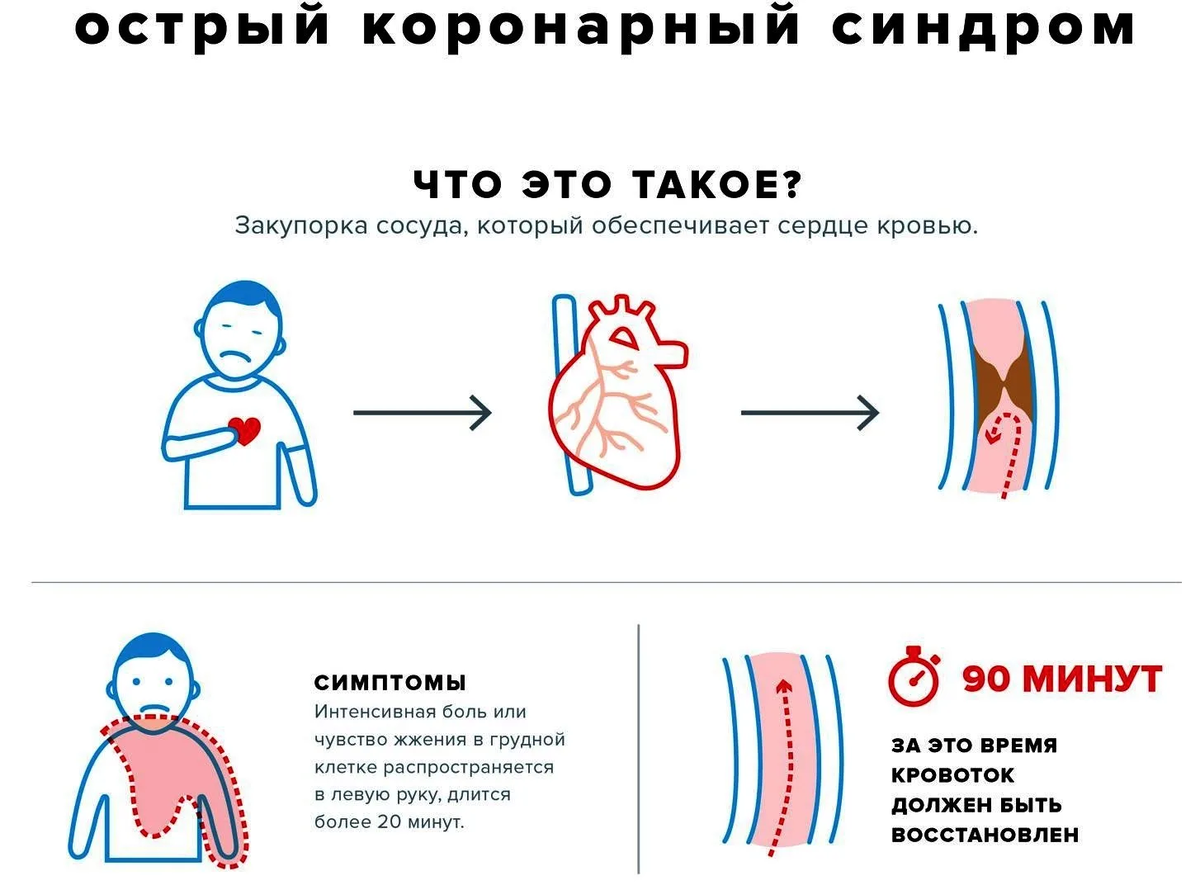 Сегодня в неотложной кардиологии широко применяется понятие – острый коронарный синдром.-2