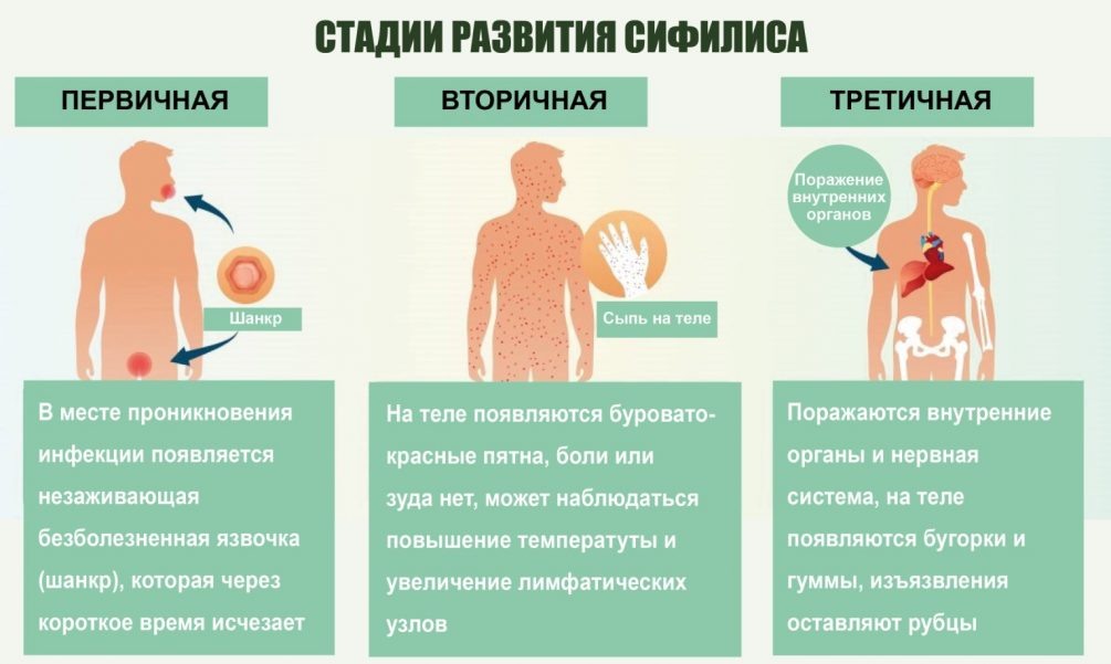 Уретрит у мужчин. Автор статьи: врач-уролог Искандаров Айдар Раушанович.