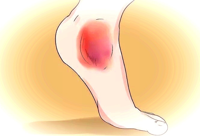 Фото из интернета 