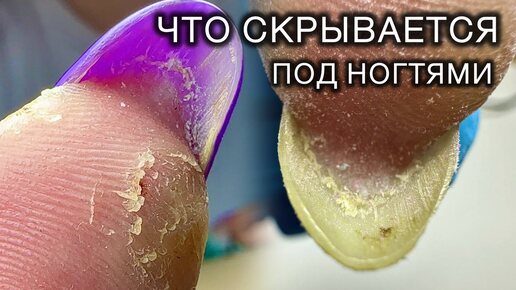 НЕ ПОВТОРЯТЬ - ЧТО Я ДЕЛАЮ С ОГРОМНЫМ ГИПОНИХИЕМ