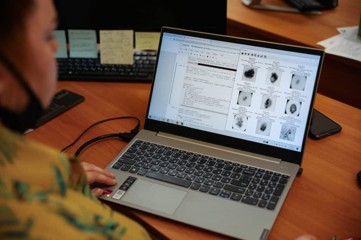    Ученые проанализировали более 10 тысяч статей по диагностике рака кожи и составили релевантную выборку из более сотни исследований, посвященных участию ИИ в диагностике / © Ульяна Ляхова, пресс-служба РНФ