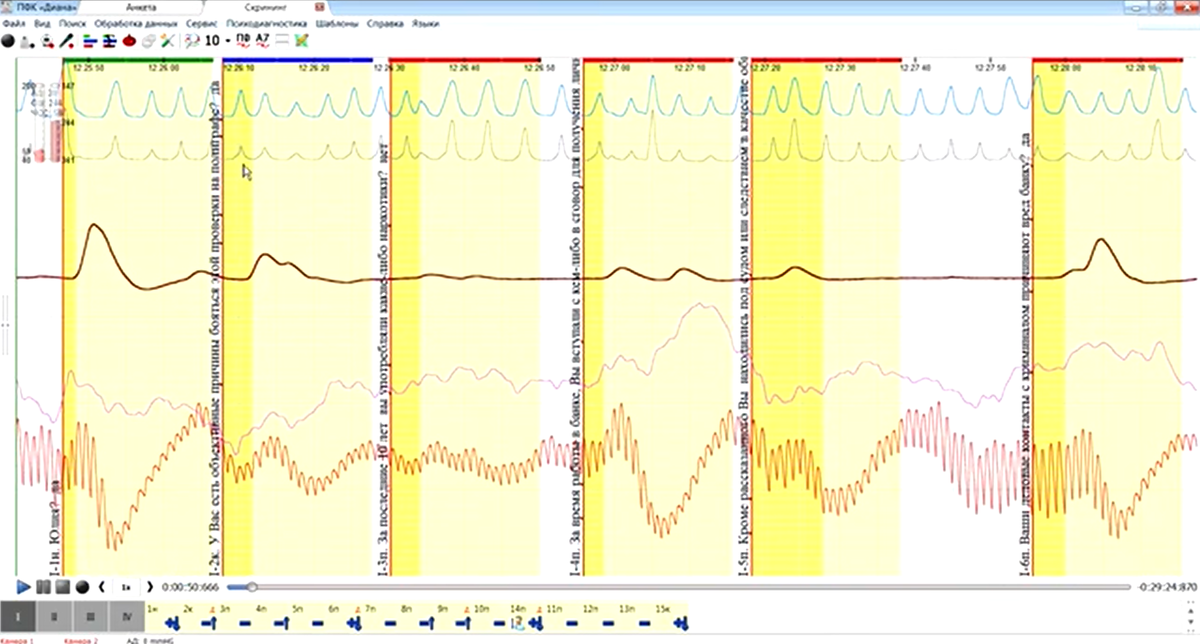 Пример полиграммы, полученной с помощью полиграфа «Диана»