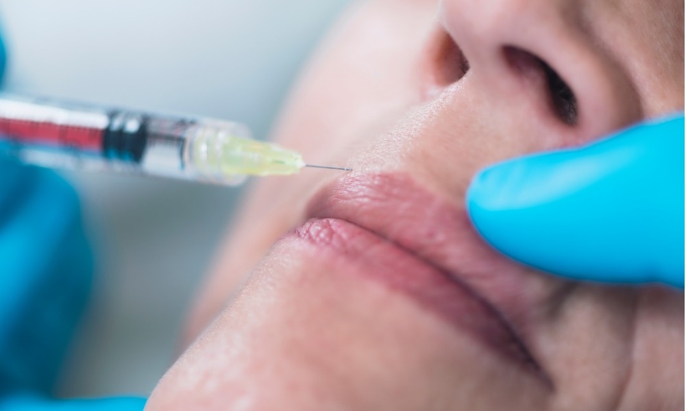 حقن هيدروكسيباتيت للوجه والشفاه