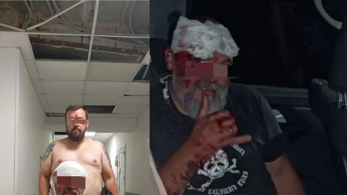    Бойцы 88-й РДБр «Эспаньола», находившиеся на лечении в горбольнице Мариуполя.