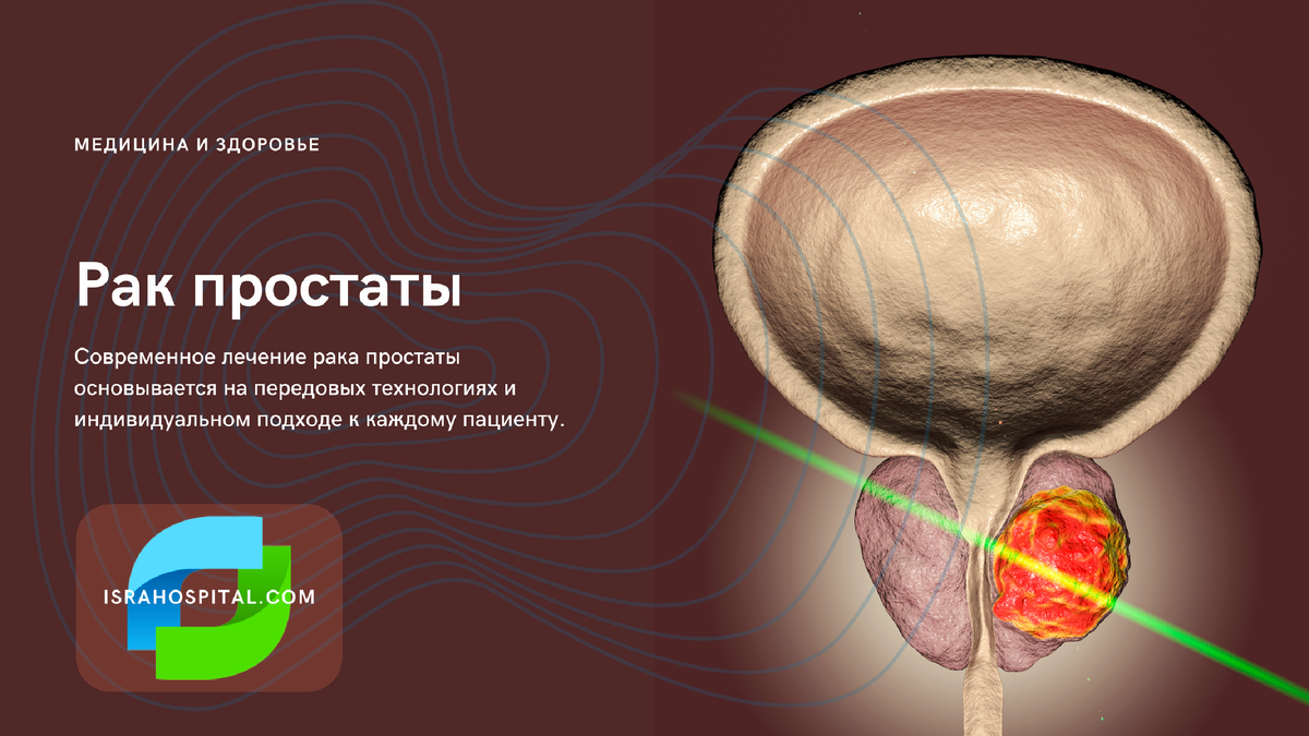 Персонализированное лечение рака предстательной железы 