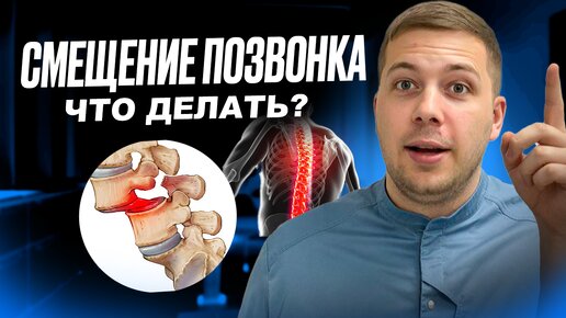 СПОНДИЛОЛИСТЕЗ. Что такое настоящее смещение позвонка?