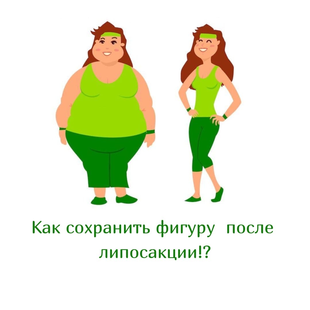 Жизнь после липосакции: как не набрать заново лишние килограммы?