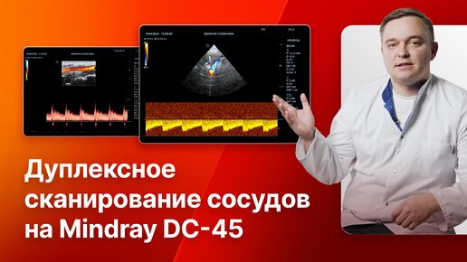 Дуплексное сканирование сосудов шеи, головного мозга, брюшной аорты и ее ветвей на Mindray DC-45