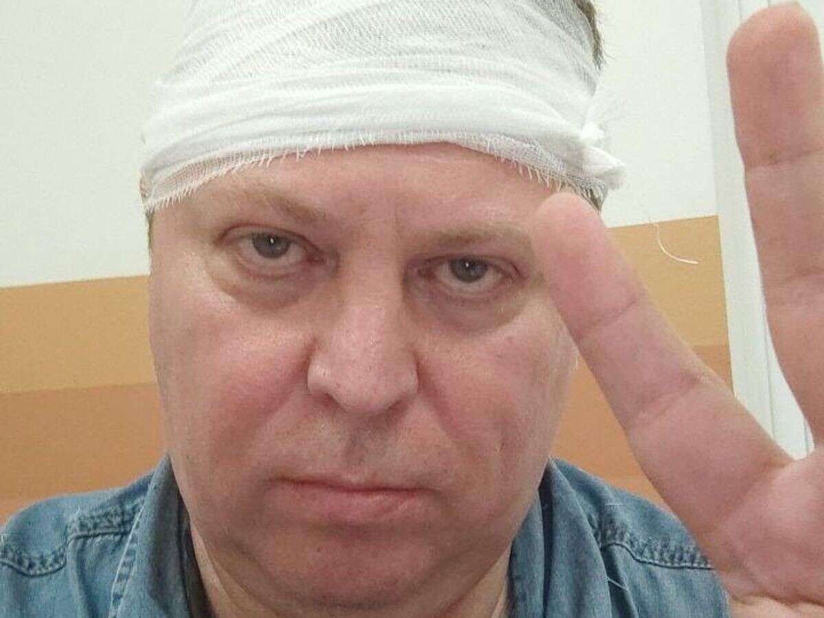    Депутат Госдумы Михаил Матвеев после нападения© Фото : Михаил Матвеев коммент/Telegram