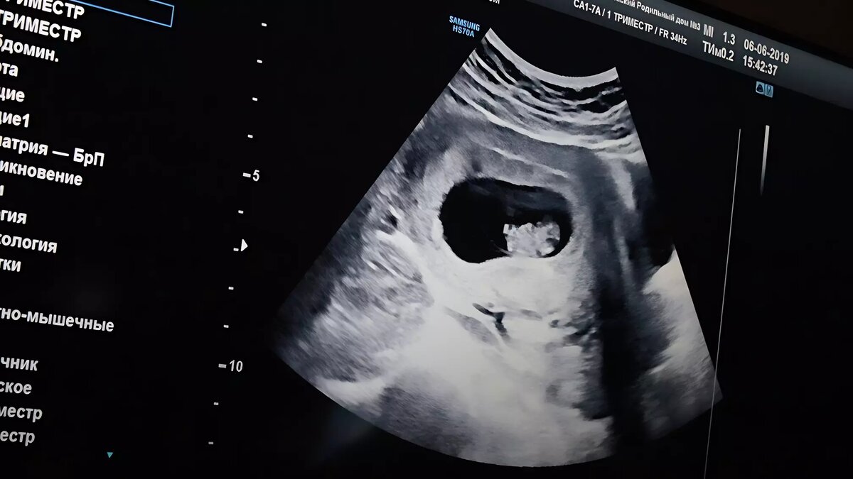     Источник: 1MI