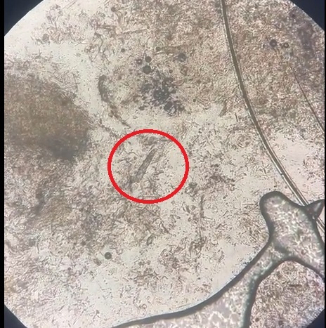 Фото предоставлено дерматологом Хаджи Е.И.