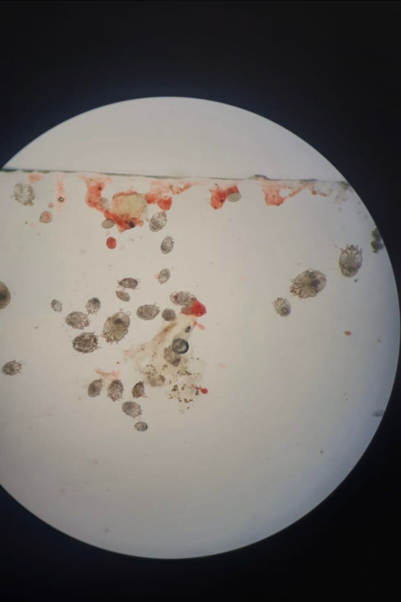 Фото предоставлено дерматологом Хаджи Е.И.