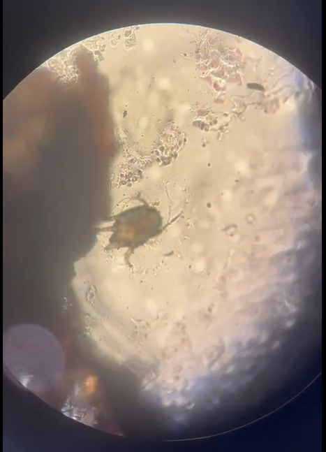 Фото предоставлено дерматологом Хаджи Е.И.