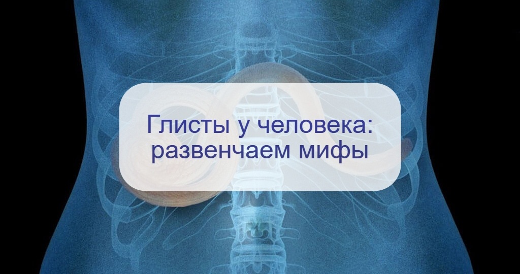 Иммунолог развенчала основные мифы о глистах: скрип зубами и сырая рыба – причем тут они?
