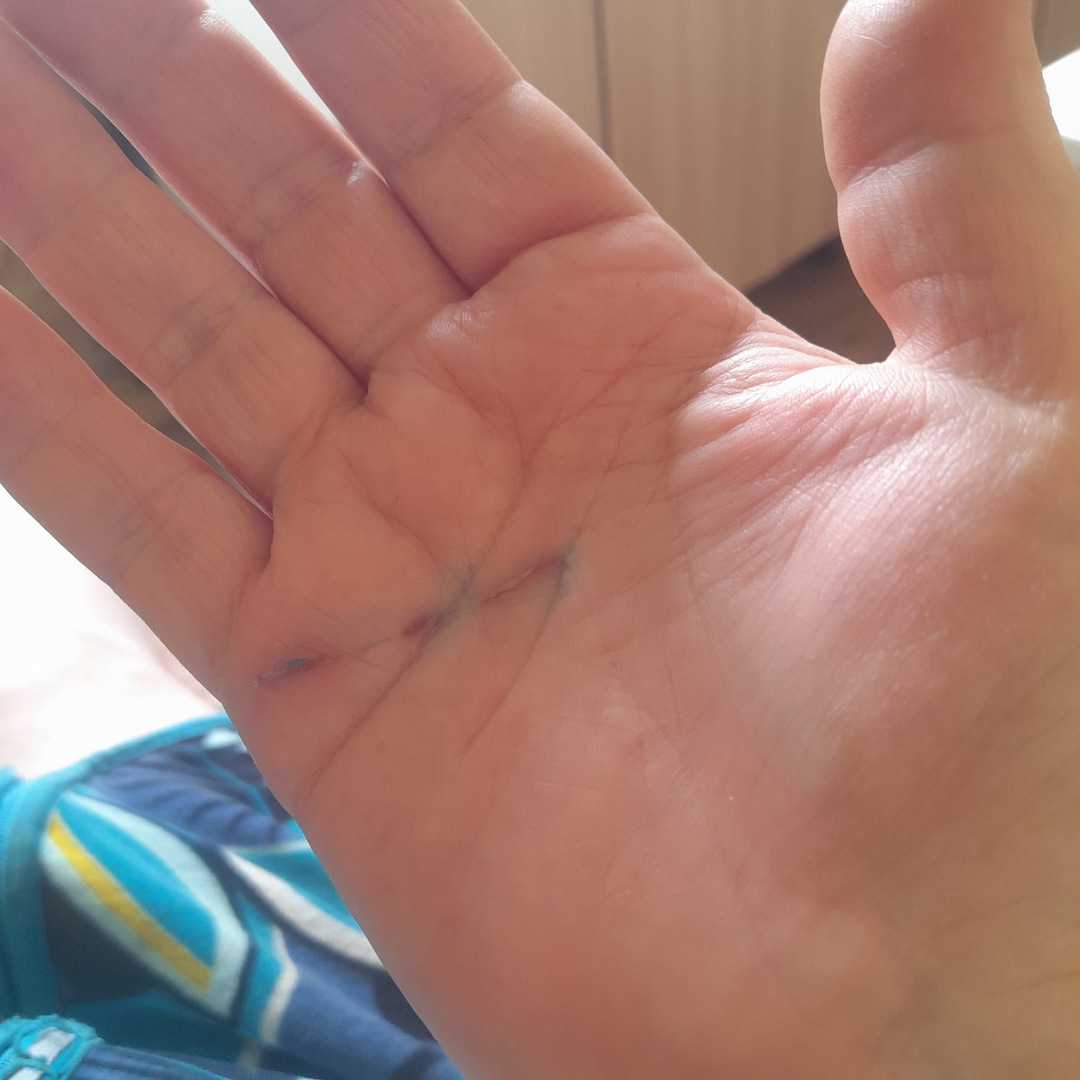 Фото автора. Бедные мои руки! А более мелких царапин не счесть