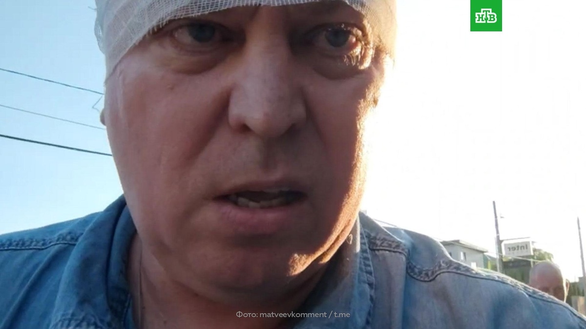    Депутат Госдумы заявил, что ему разбили голову мигранты