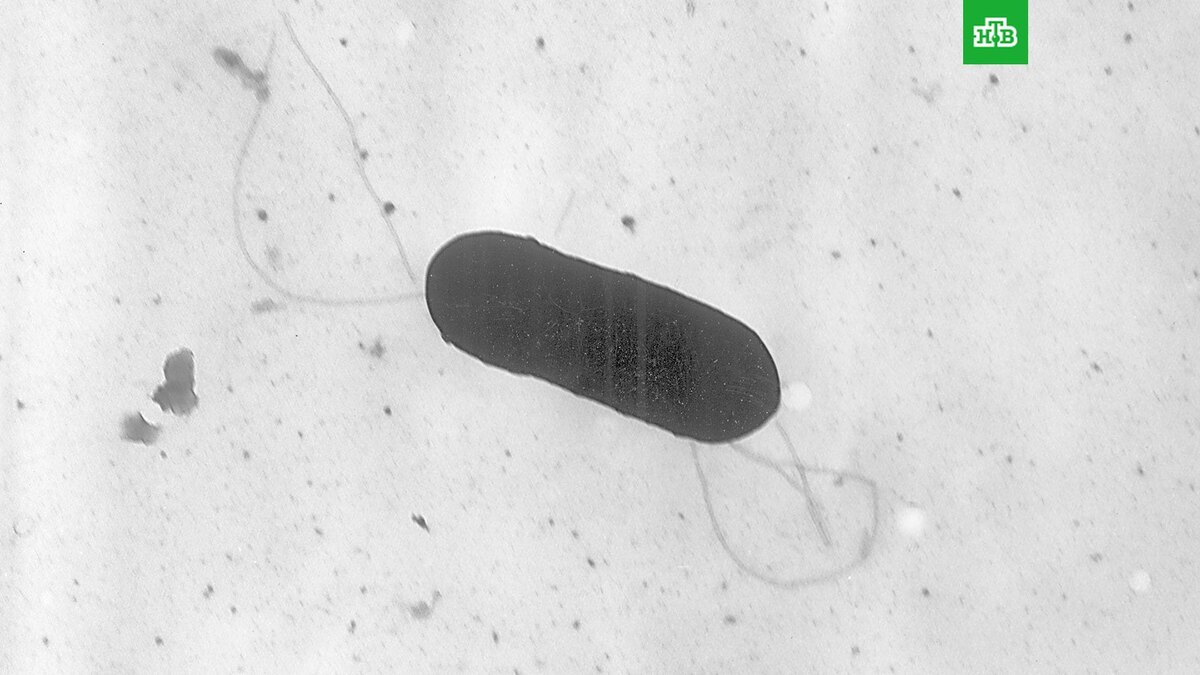    Фото: Elizabeth White / CDC / AP