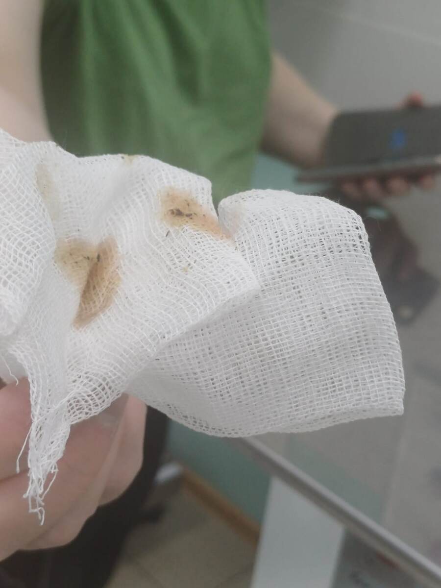 Содержимое ушей