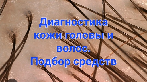 Аппаратная диагностика кожи головы и волос. Подбор средств.