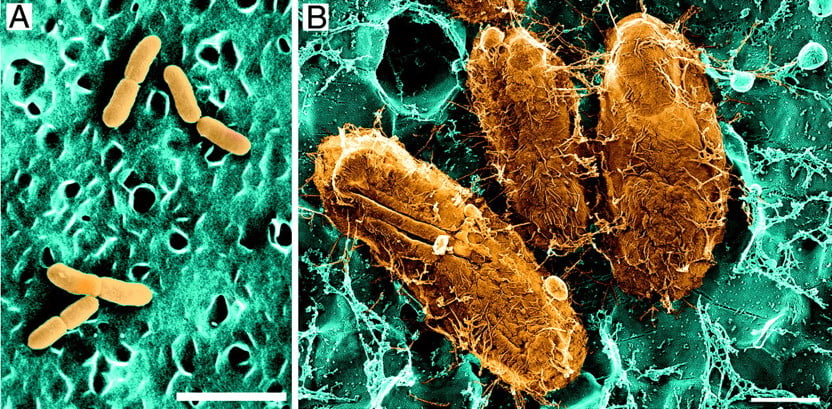 Уропатогенная Escherichia coli. Фото: S. Hultgren, J. Heuser, Washington University School of Medicine in St. Louis.