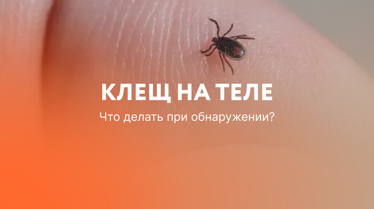 Что делать, если нашли клеща на теле?