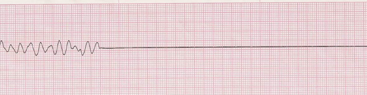 фото пример с https://jeopardylabs.com/print/cardiac-ekg