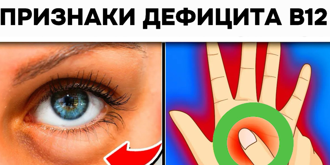 15 признаков дефицита витамина B12, которые заметны внешне
