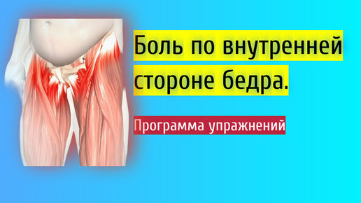 Боль в районе паха, по внутренний стороне бедра. ARS синдром. Синдром приводящих мышц. Тендинопатия приводящих мышц.