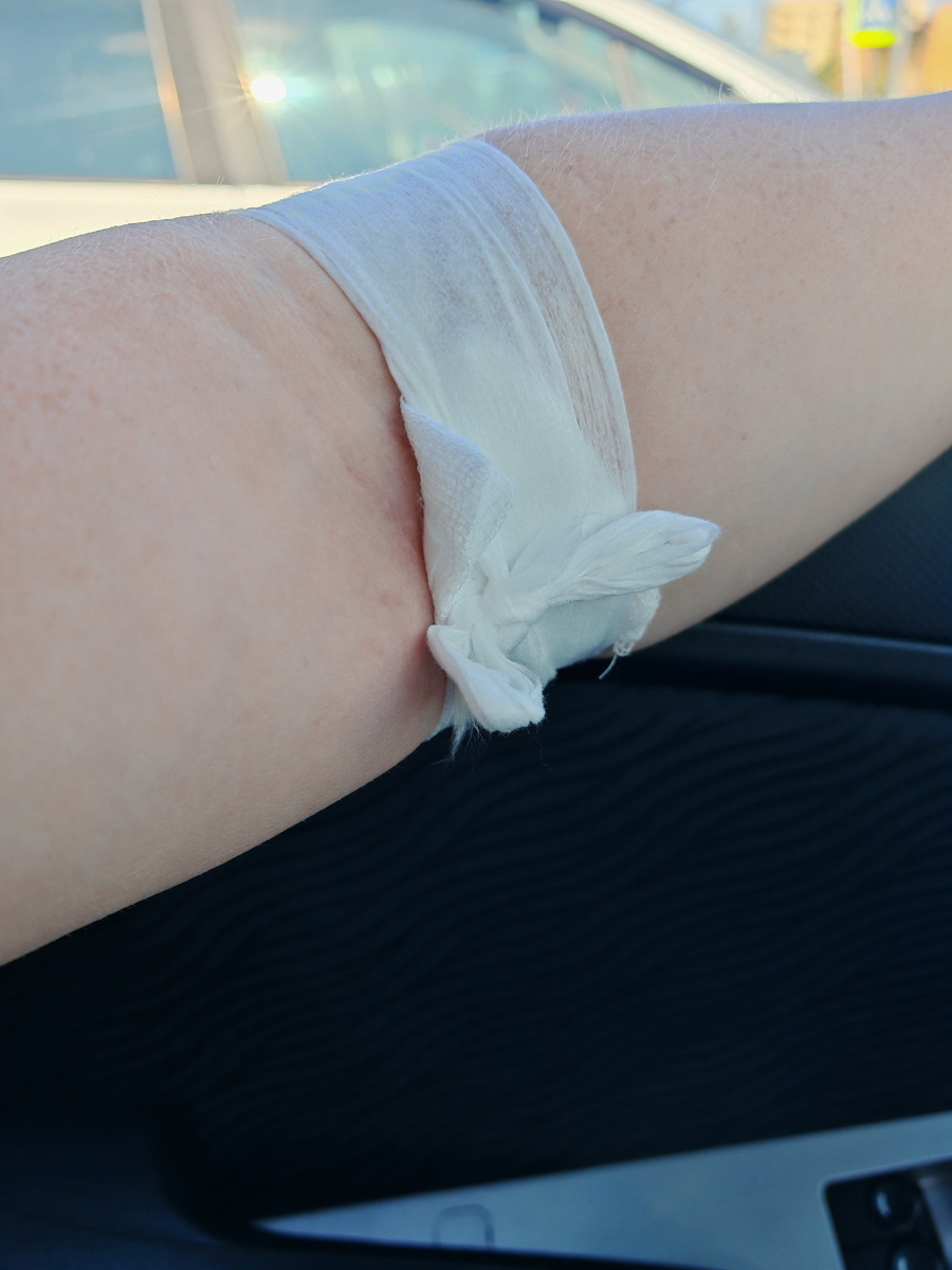 После капельницы руку забинтовали