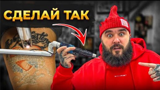 Descargar video: Как НУЖНО удалять Татуировки САМЫЙ тяжелый случай