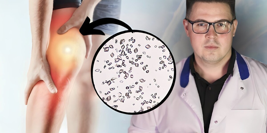 Мочевая кислота в суставах: причины образования и опасность для здоровья