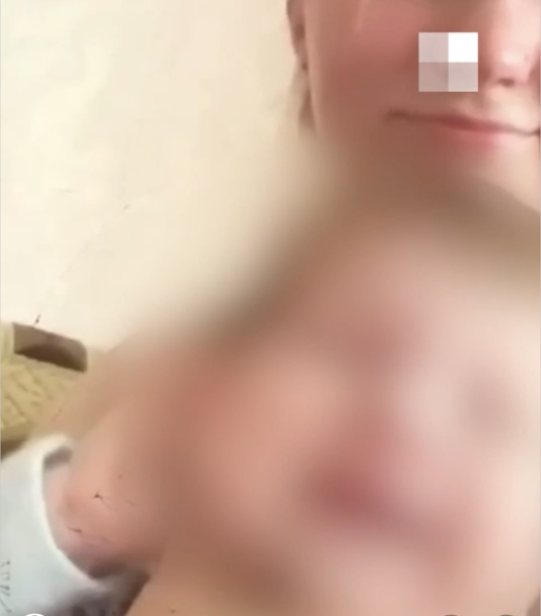 Улыбается и душит