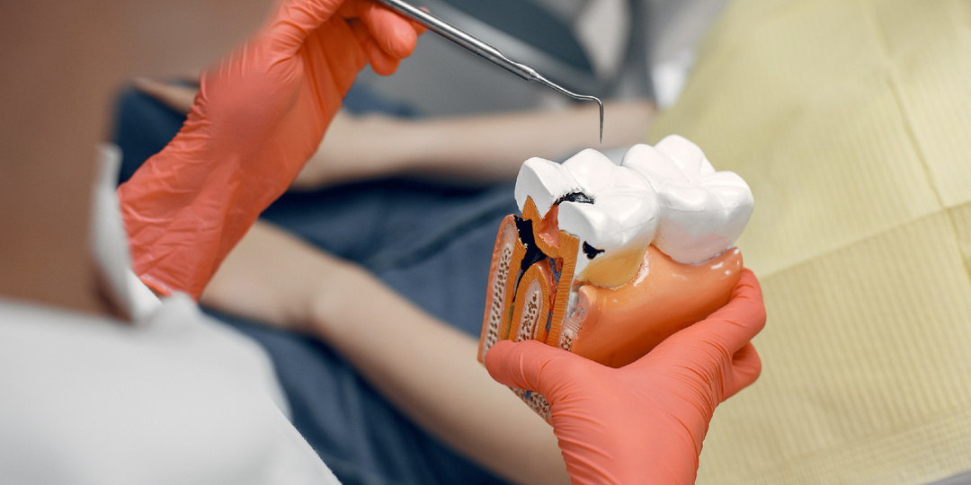 Чем опасен кариес - возможные осложнения