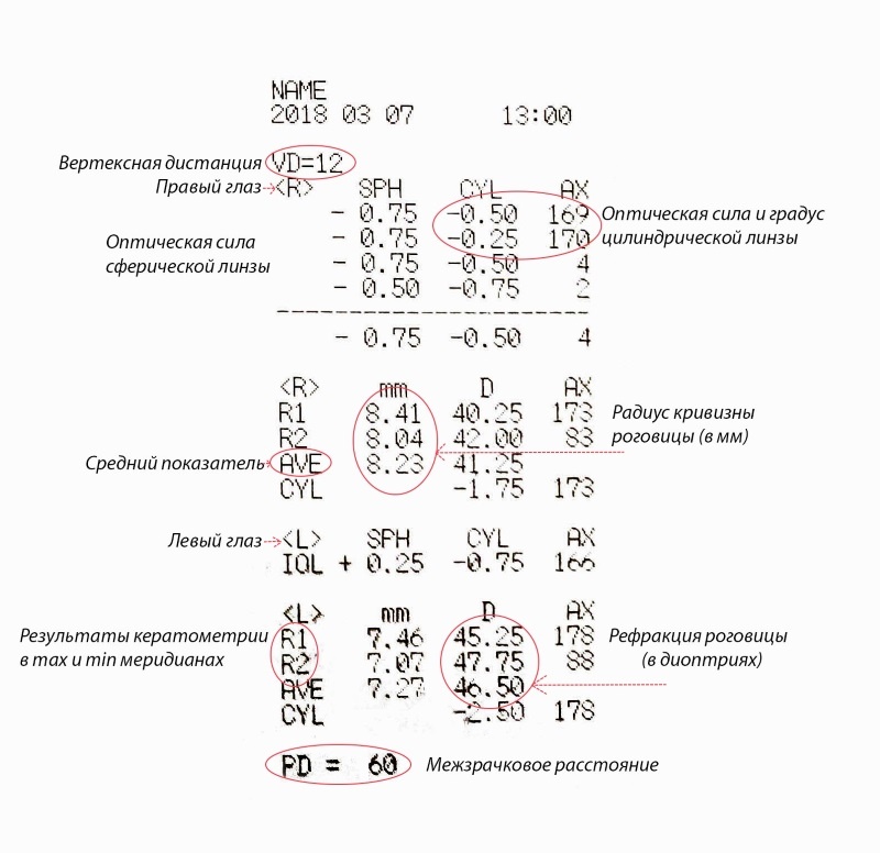 Авторефрактокератометрия