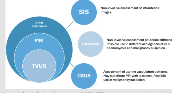 диагностические инструменты для полной оценки миомы матки. УЗИ CESU - с контрастным усилением; МРТ - магнитно-резонансная томография; SIS - соногистерография с инфузией физиологического раствора; ТВУЗИ - трансвагинальное УЗИ.
