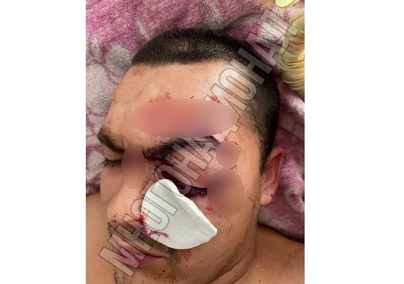    Пострадавший в драке.