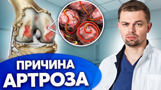 Скрытые причины боли! Как ПАРАЗИТЫ влияют на суставы?