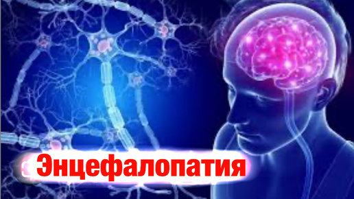 Энцефалопатия - всё, что нужно знать.