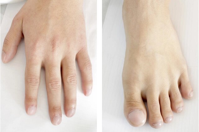    Фото: istockphoto.com