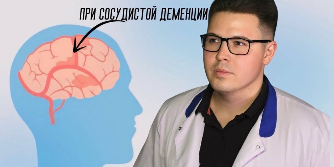 Первые признаки сосудистой деменции: не пропустите важные сигналы
