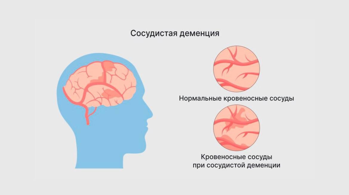   ,  ,       ,   .           ,      .-2