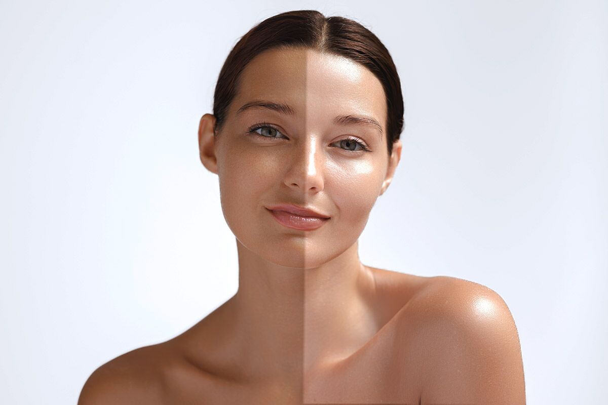 Переборщили с солярием или слишком долго загорали на пляже? Осветлить кожу и добиться равномерного тона можно с помощью домашнего ухода. Источник: Shutterstock📷
