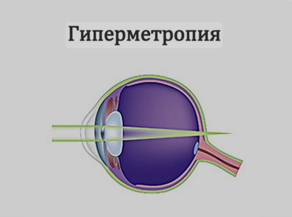 Глазные заболевания.