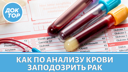 Врач-онколог объяснил, как по анализу крови заподозрить рак