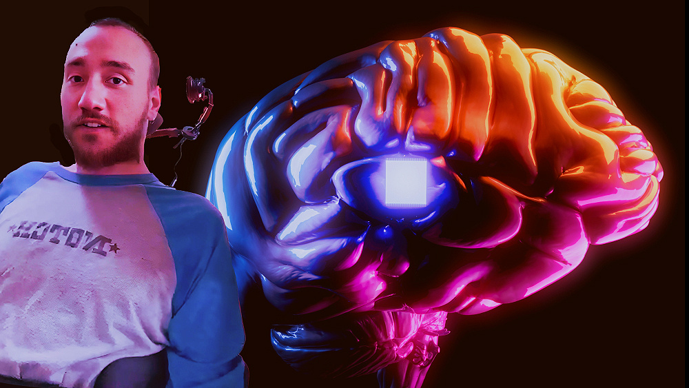    Фото: Shutterstock.com; Neuralink/Ferrari Press/East News
