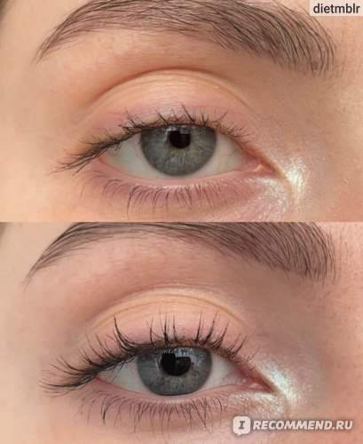 ДО и ПОСЛЕ сыворотки Toplash