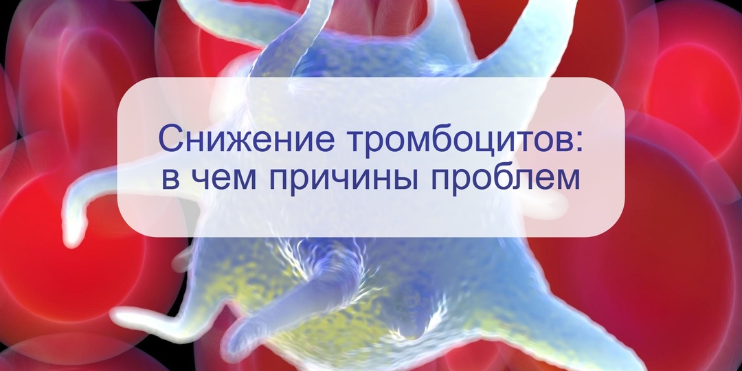 «Читаем» анализ крови – почему понижены тромбоциты и как это корректировать
