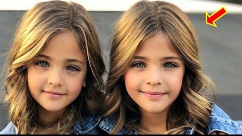 В 2017 году их называли самыми красивыми близняшками! Посмотрите какие они сейчас!